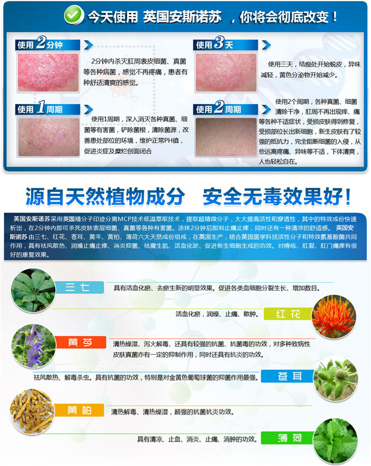 英国安斯诺苏痔疮膏效果